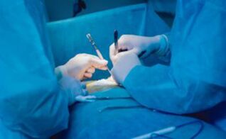 Ligamentotomy - operasi untuk meningkatkan panjang zakar